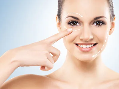 A woman&rsquo;s face with treatment guide lines around the eyes