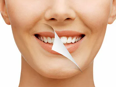 A smiling woman with bright, white teeth